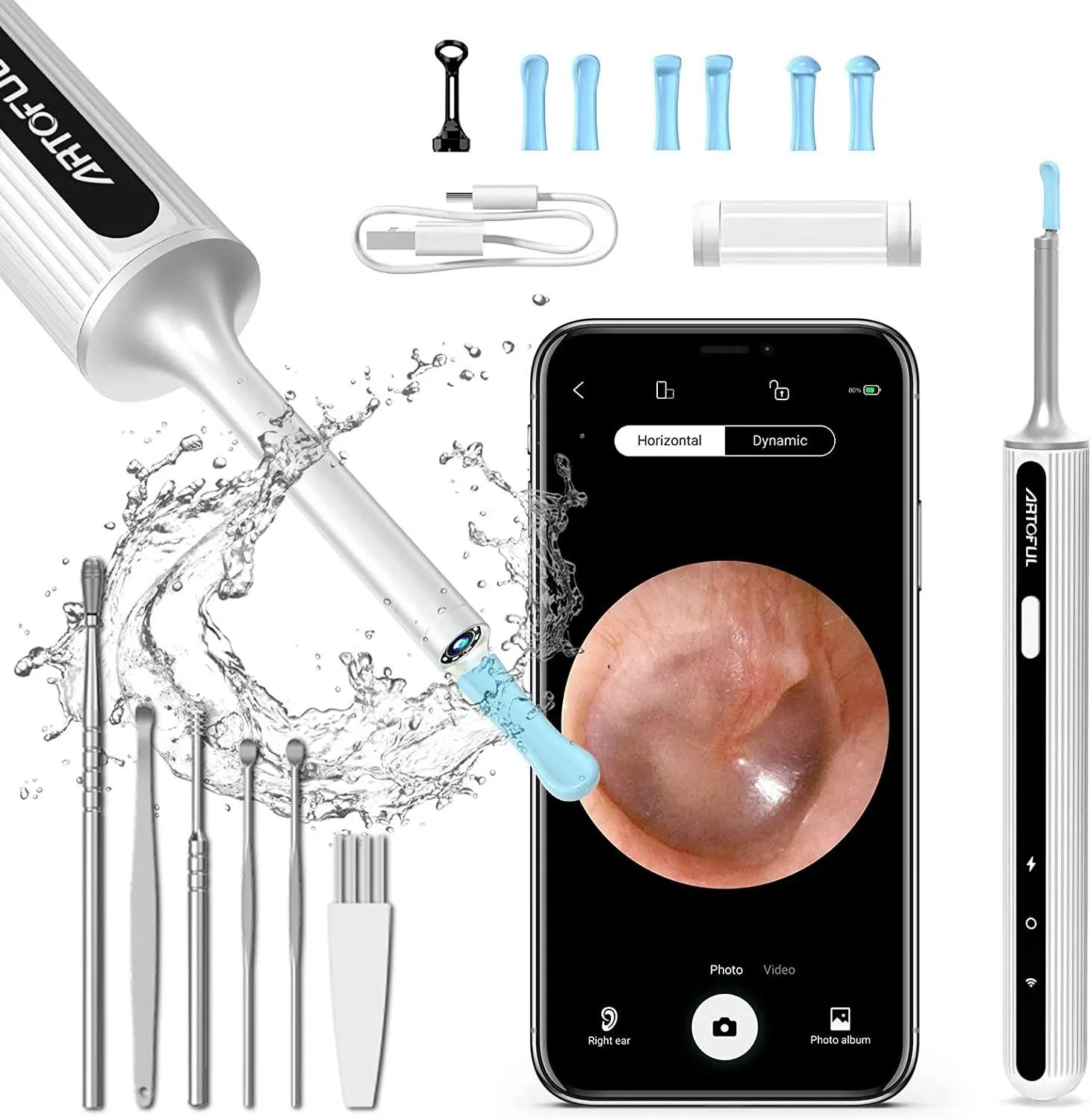 Otoscope